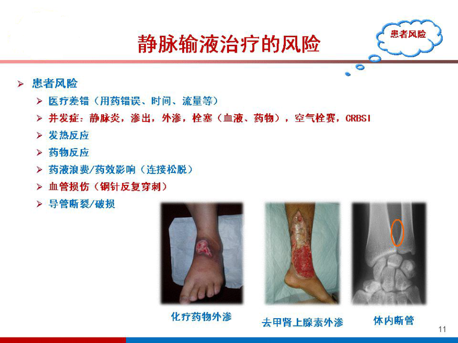 静脉治疗的安全管理.ppt_第3页