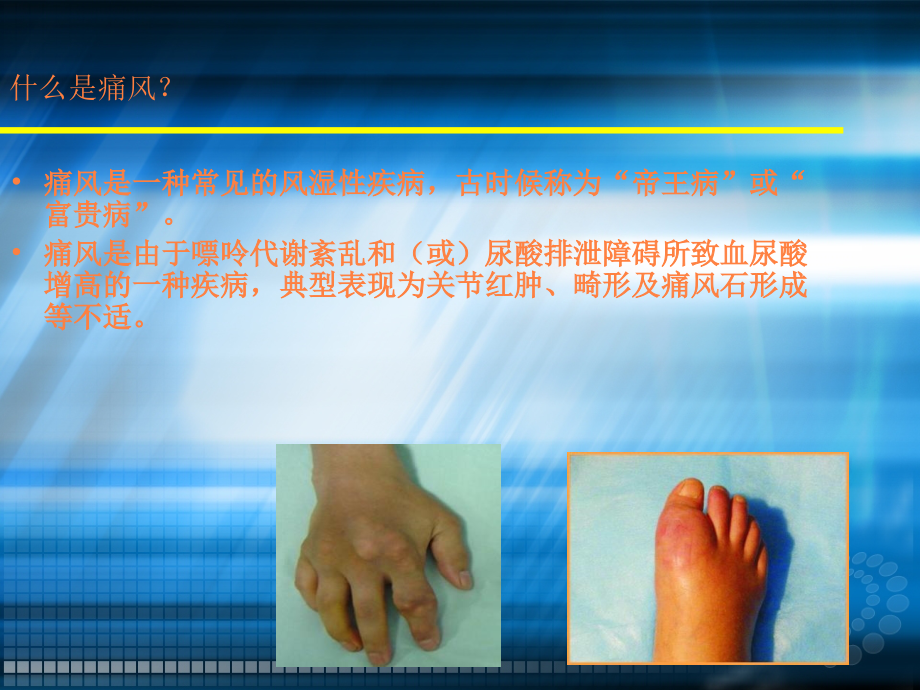 痛风健康科普讲座.ppt_第2页