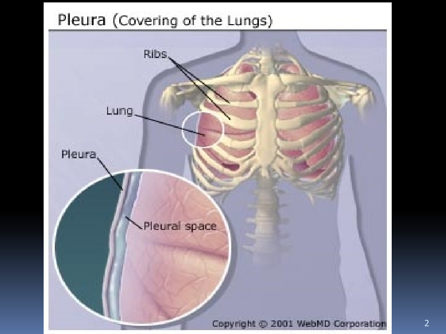 胸腔积液临床表现-.ppt_第2页