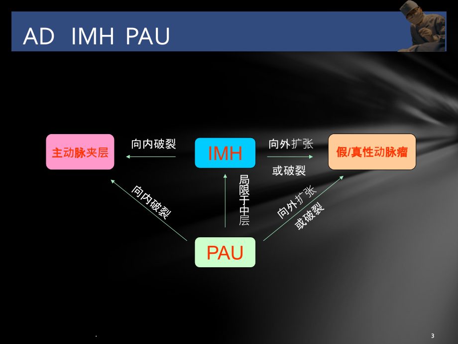 主动脉夹层、壁间血肿及穿通性溃疡.ppt_第3页