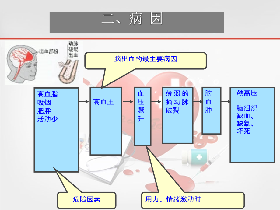 脑出血的护理(1).ppt_第3页