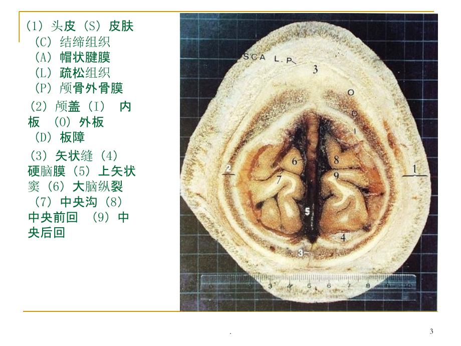 人体断层解剖图谱(大脑).ppt_第3页