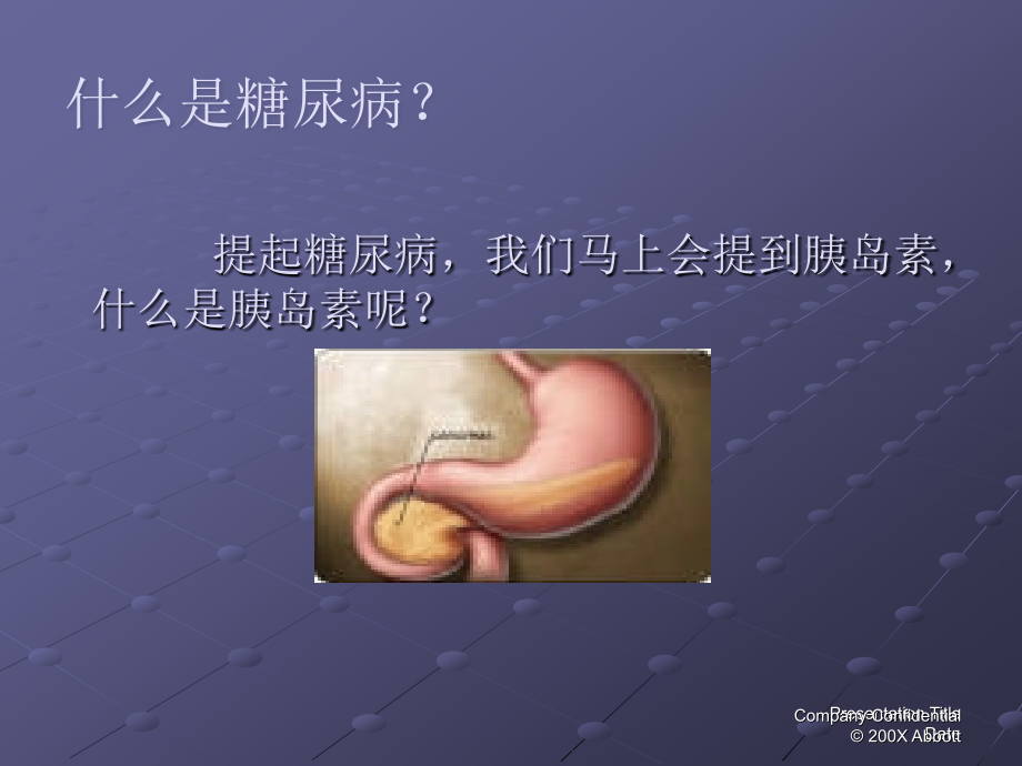 糖尿病综合治疗.ppt_第3页