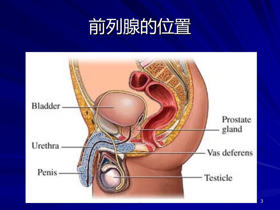 前列腺癌诊断治疗与护理.ppt_第3页