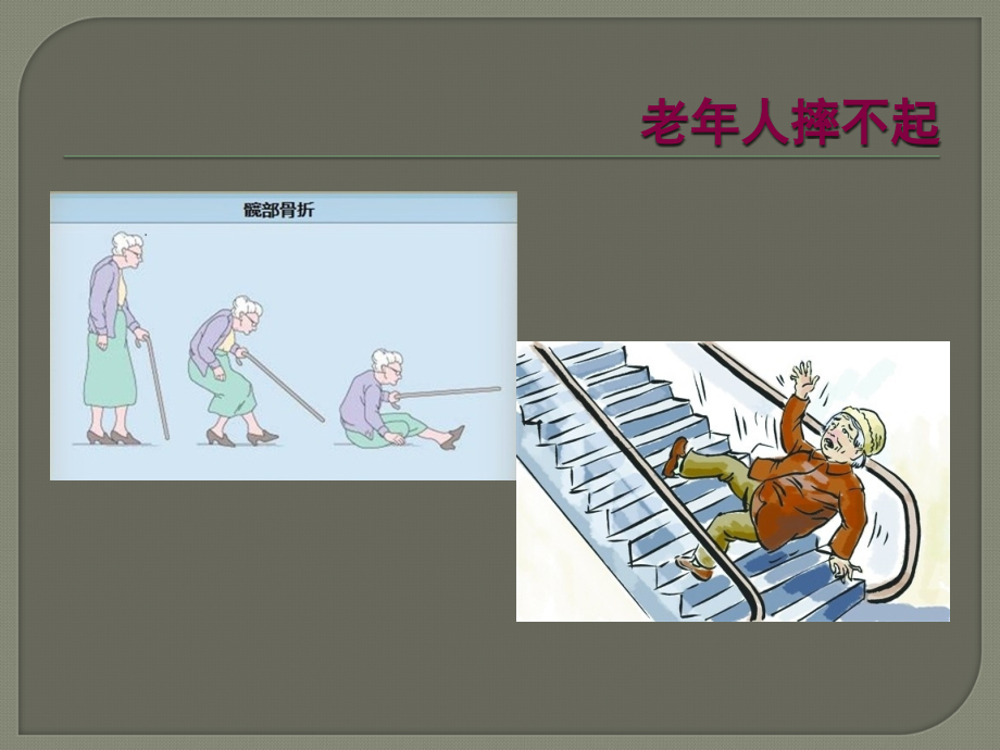 老年髋部骨折护理与配合.ppt_第2页