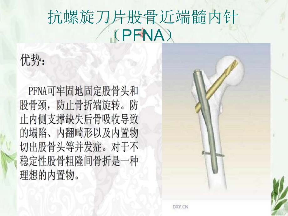 股骨粗隆间骨折手术配合.pptx_第2页