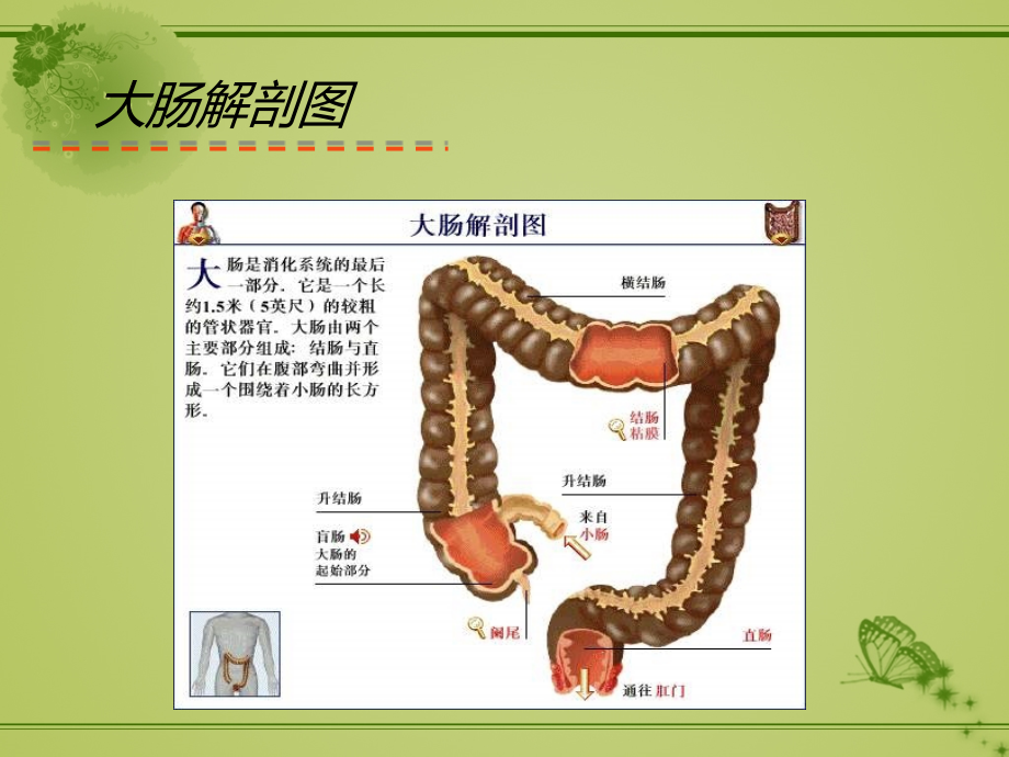 直肠癌的教学查房.ppt_第3页