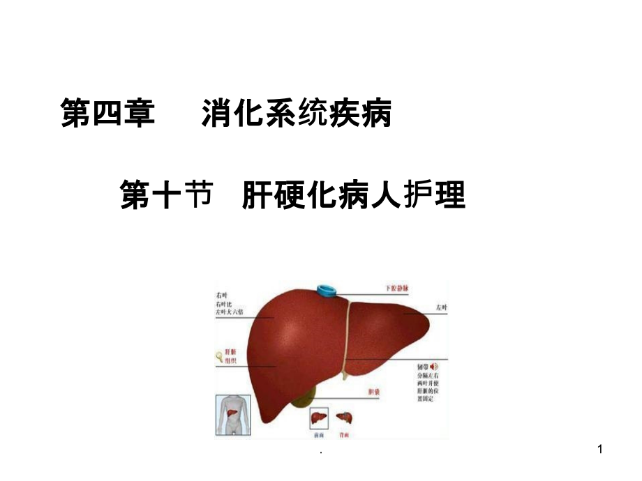 内科护理学课肝硬化.ppt_第1页