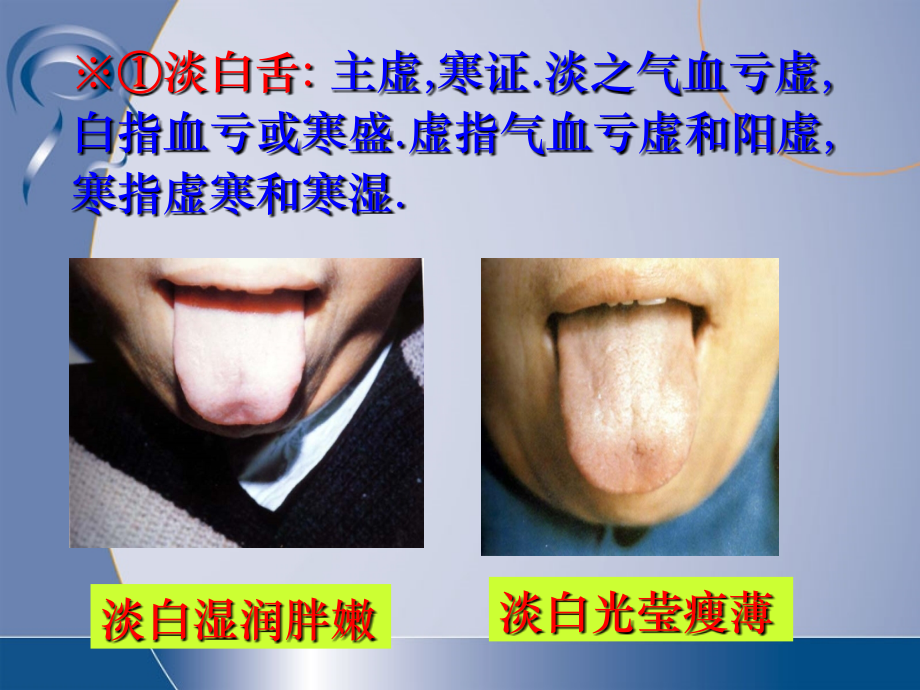 中医诊断学---舌诊图谱.ppt_第3页