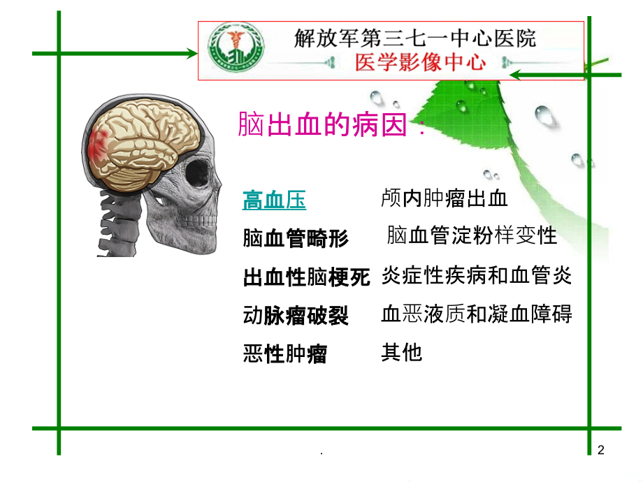 脑出血的MRI表现PPT课件.ppt_第2页