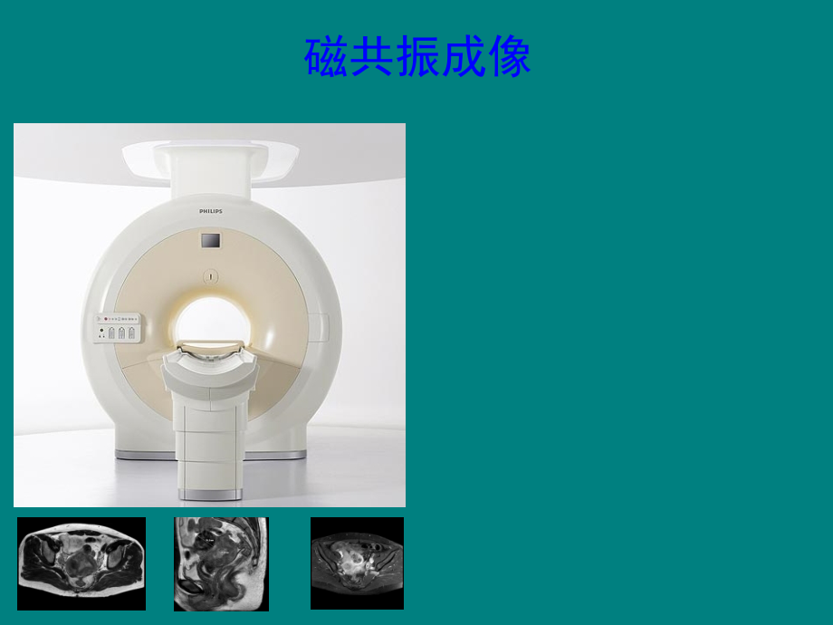 子宫内膜癌MRI影像表现.ppt_第2页