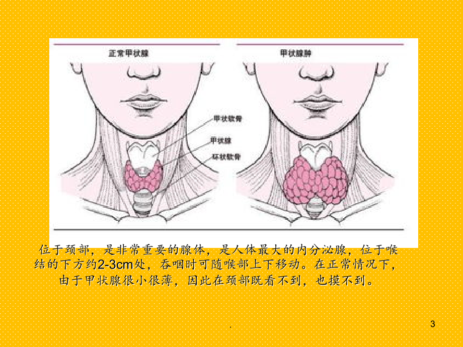 妊娠合并甲状腺疾病(1).ppt_第3页