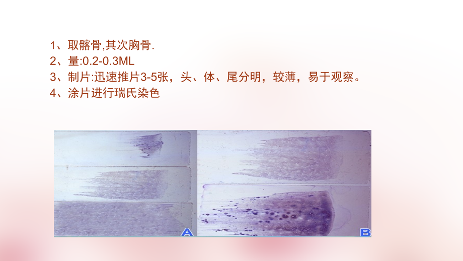 正常骨髓形态学检查.ppt_第3页