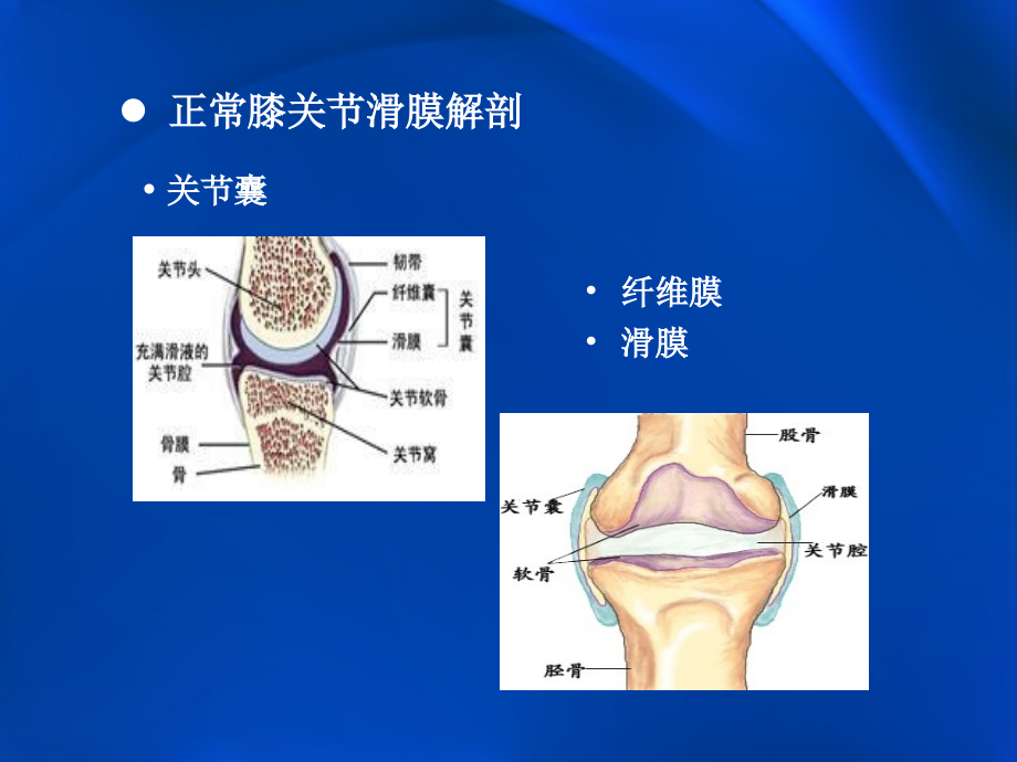 膝关节滑膜病变MRI.ppt_第3页