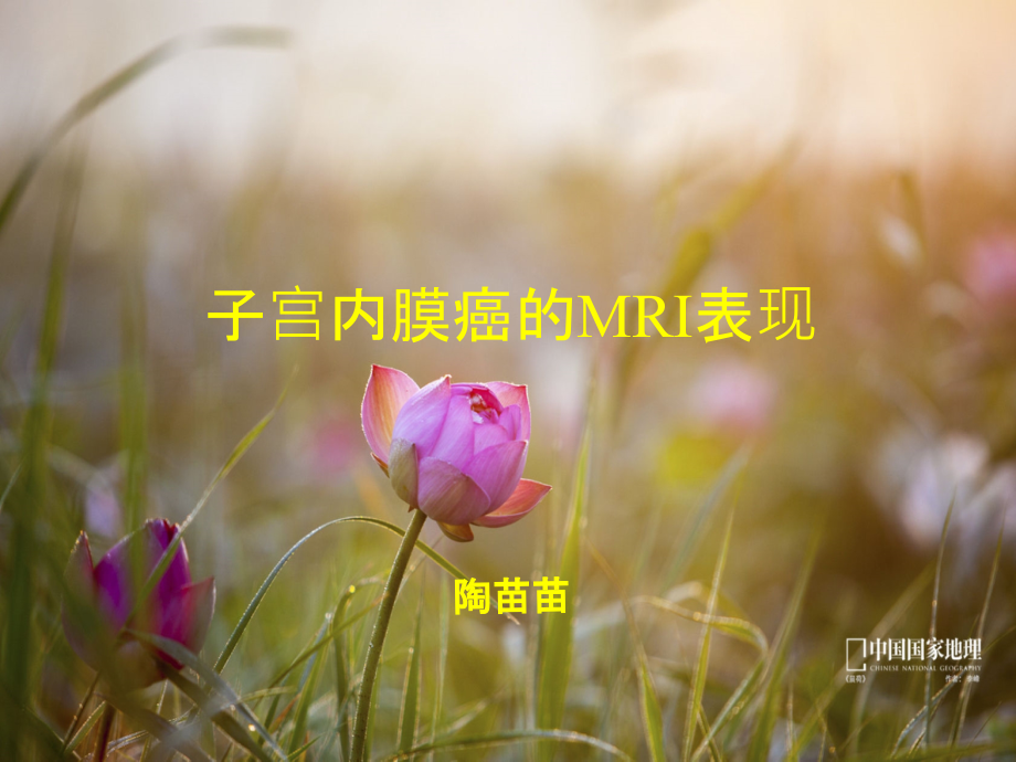 子宫内膜癌MRI影像表现课件.ppt_第1页