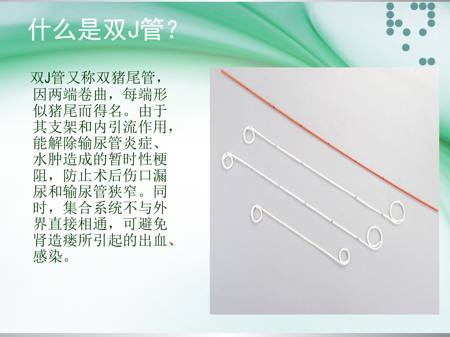 留置双J管的健康指导.ppt_第2页