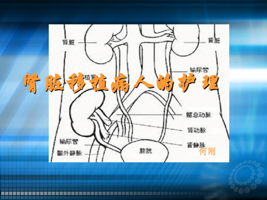 肾移植的护理ppt课件.ppt_第1页