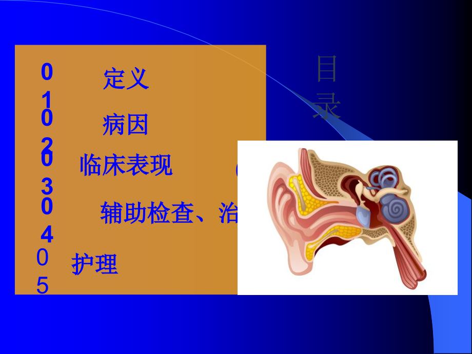 突发性耳聋PPT52976.ppt_第3页