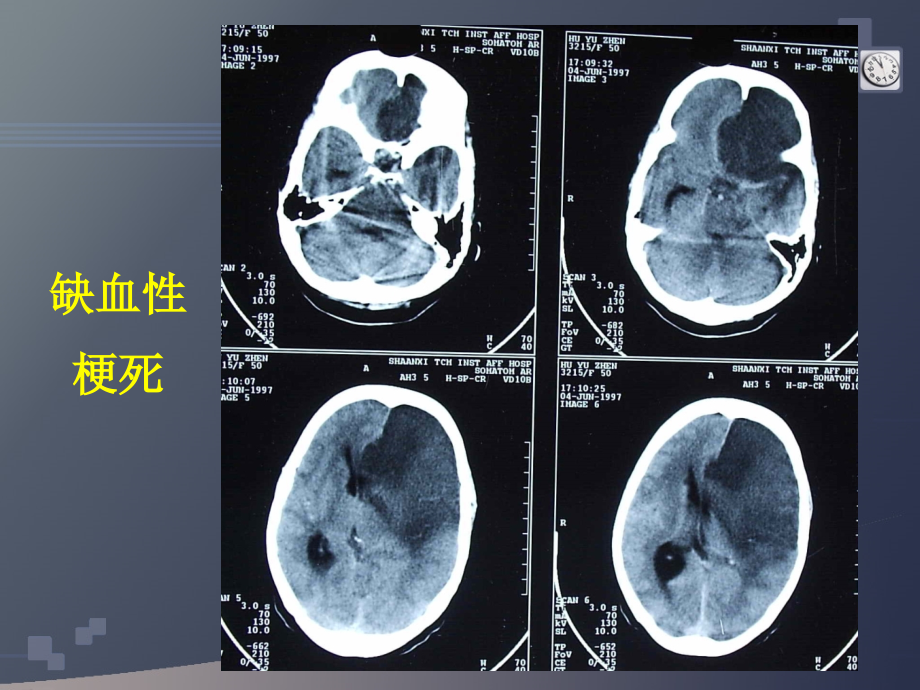 研究生医学影像学-颅脑.ppt_第1页