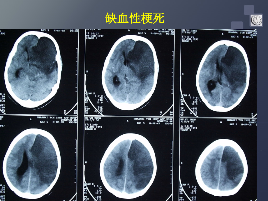 研究生医学影像学-颅脑.ppt_第2页