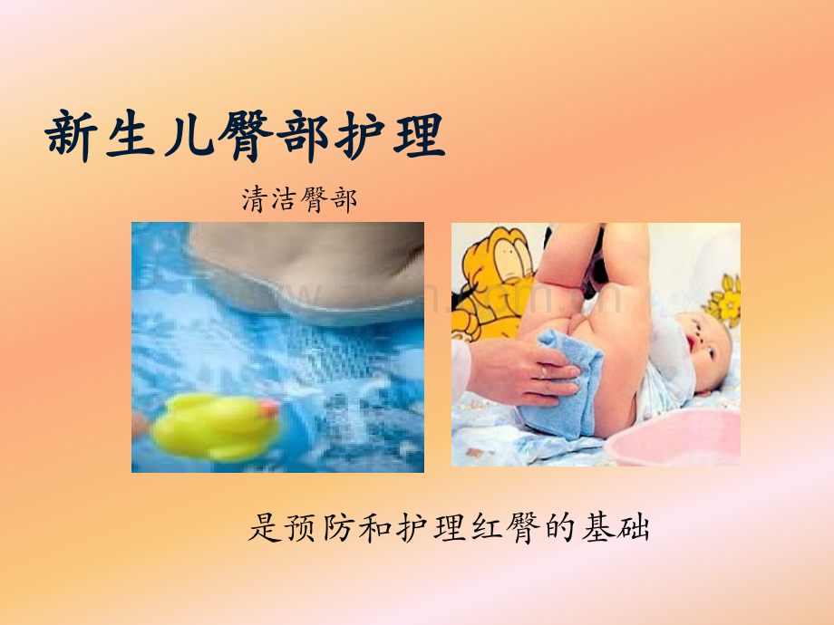 新生儿臀部护理刘嫦娥.ppt_第3页