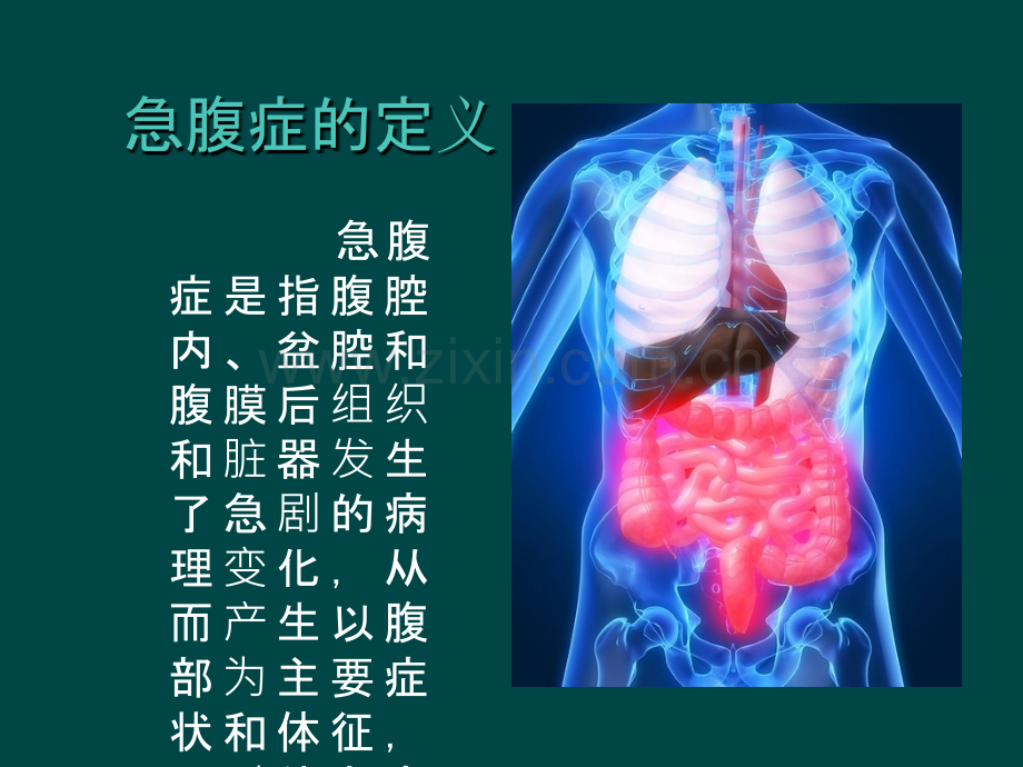 急腹症的影像表现.ppt_第2页