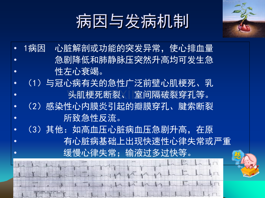 急性左心衰的急救流程和医疗护理讲义.ppt_第3页