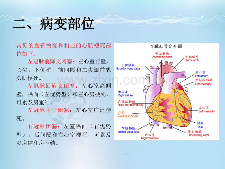 冠心病心肌梗死-.ppt_第3页