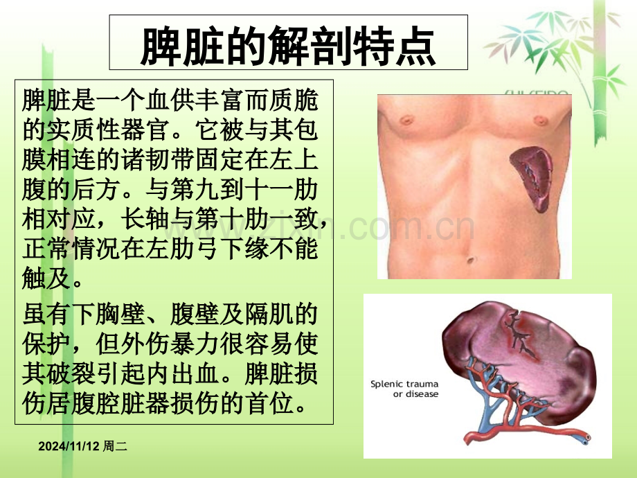 医学课件外伤性脾破裂的医疗护理查房宣讲.ppt_第1页