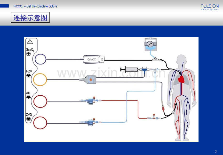 PiCCO血流动力学监测课件.ppt_第3页